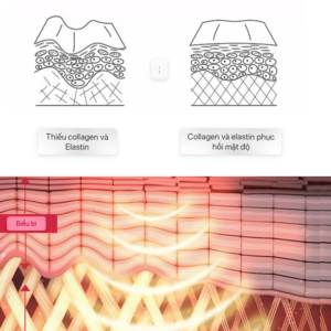 Máy Làm Sạch Da & Chăm Sóc Mặt Chuyên Sâu OMEG STUDIO – Công Nghệ Siêu Âm & Oxy Hoạt Tính - Hình ảnh 4